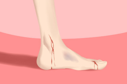 女人梦见脚受伤流血是怎么回事